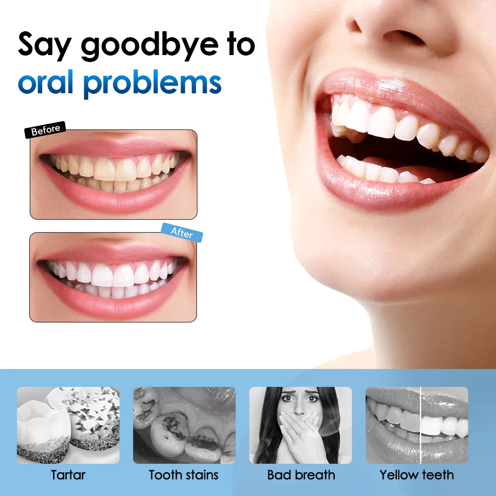 Electric Teeth Cleaner Remove Tartar Plaque Calculus and Tooth Stains Dental Teeth Whitening Kits With 6 Toothbrush Heads Home