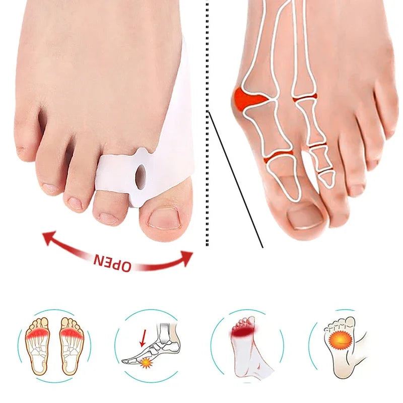 Thumb Valgus Corrector Thumb Valgus Corrector Socks Toe Separator Silicone Separator