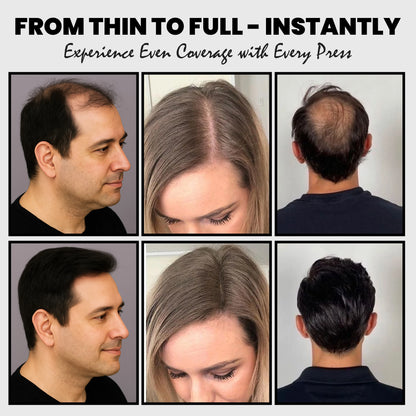 Adglamful 30g Hair Building Fiber - Spray Head Design, Precise Coverage, 5 Sec Quick Thickening for Sparse Areas & Styling